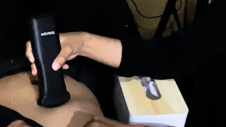 Memahami Fungsi dan Jenis Alat USG untuk Diagnostik Medis